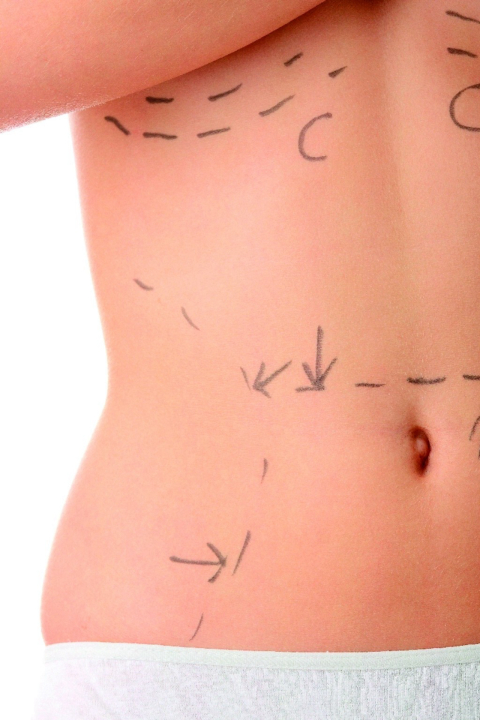 De volta ao corpo de antes da gestação