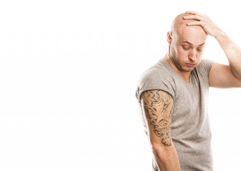Remoção a laser de tatuagens