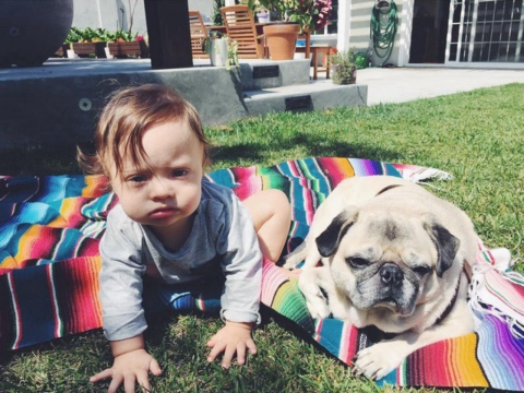 Bebê com Síndrome de Down inicia carreira de modelo