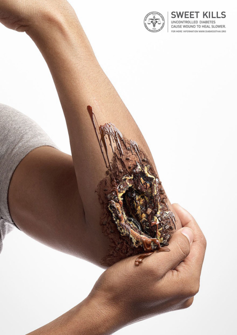 Imagens mostram os efeitos da diabete para quem não controla a doença