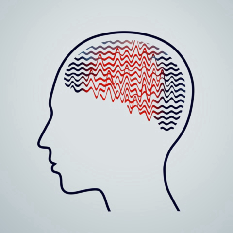 O que fazer em um caso de epilepsia?