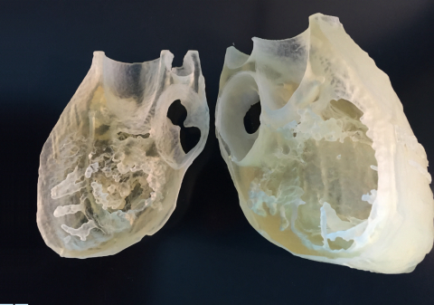 Neurocirurgião apresenta tecnologia de biomodelos em Curitiba