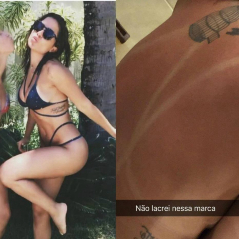 Biquíni da moda pode deixar marquinhas indesejáveis. Anitta foi uma das “vítimas”