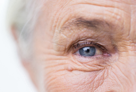 Teste genético aponta risco de desenvolver Alzheimer