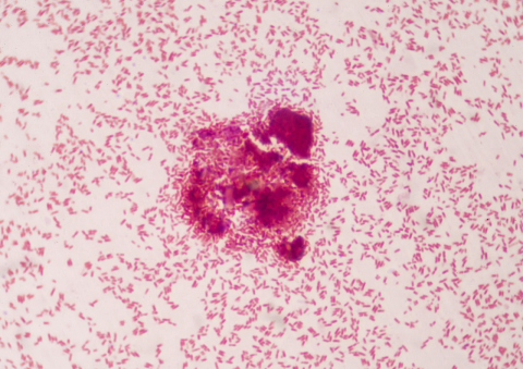 Superkit que identifica múltiplas causas de infecções deve ser lançado até 2021