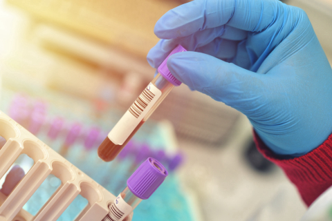 Contra o câncer de próstata, confira as diferenças entre o exame de PSA e o exame do toque retal