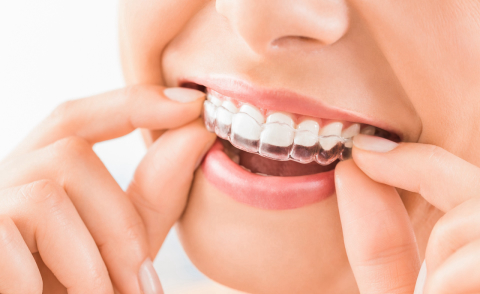 As novas armas da odontologia para harmonizar a face; e seus preços!