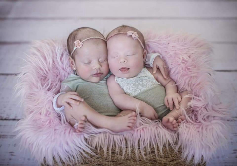 Um caso em um milhão: brasileira tem gêmeas e uma nasce com Síndrome de Down